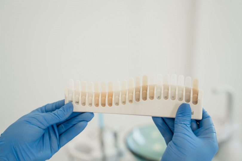 Dentista avaliando sorriso de paciente para alinhadores invisíveis ou aparelho fixo