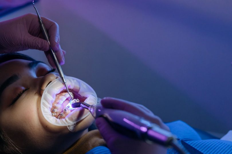 Ortodontista em consultório mostrando retentor ortodôntico removível e exemplo de contenção fixa para evitar que os dentes entortem novamente.