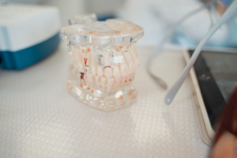 Dentista especializado em implantes analisando tomografia para planejar implante dentário com segurança