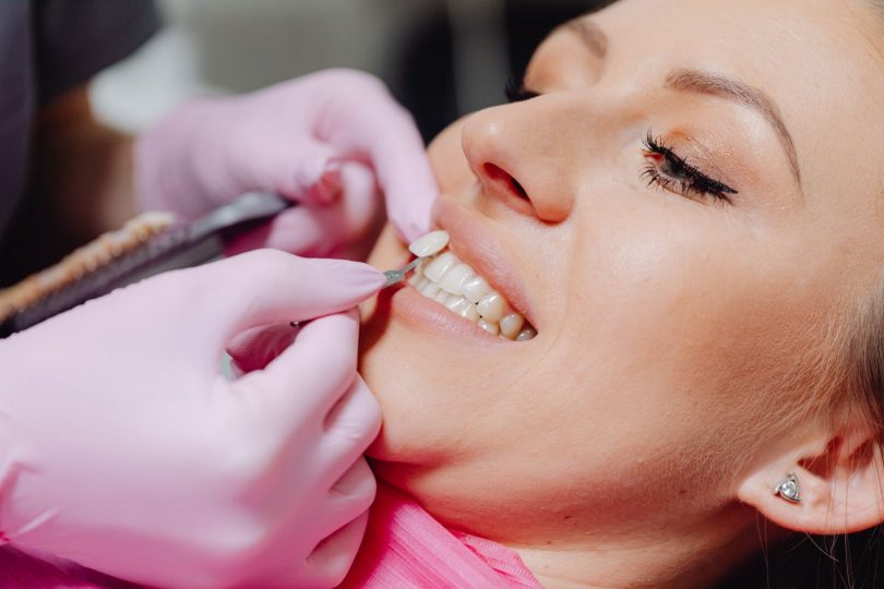 Dentista segurando modelos e facetas em resina e porcelana para comparação