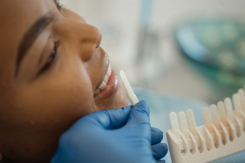 Dentista avaliando dentes anteriores para lente de contato dental com instrumentais clínicos