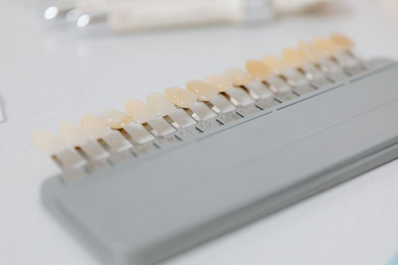 Comparação clínica entre faceta de resina composta e faceta de porcelana em dentes anteriores