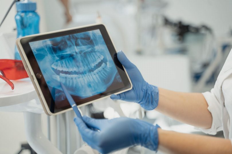 Dentista realizando escaneamento intraoral para planejamento de estética dental
