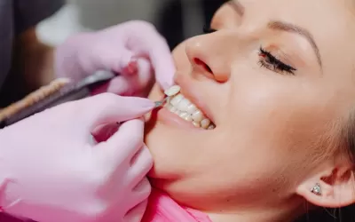 Dentista segurando modelos e facetas em resina e porcelana para comparação