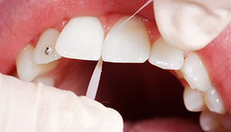 Periodontia